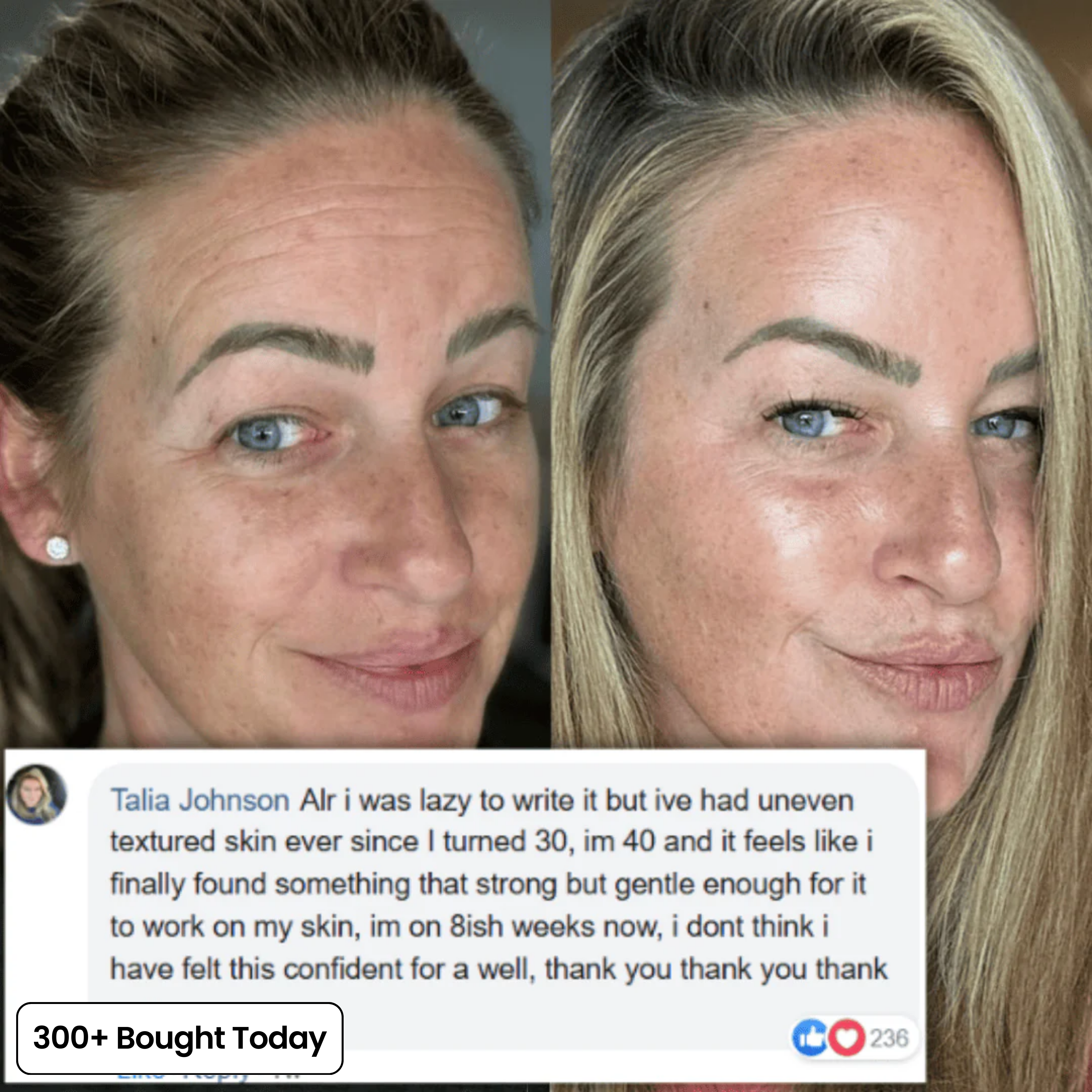 PDRN Glow Balm gegen müde Augenpartie und feine Linien