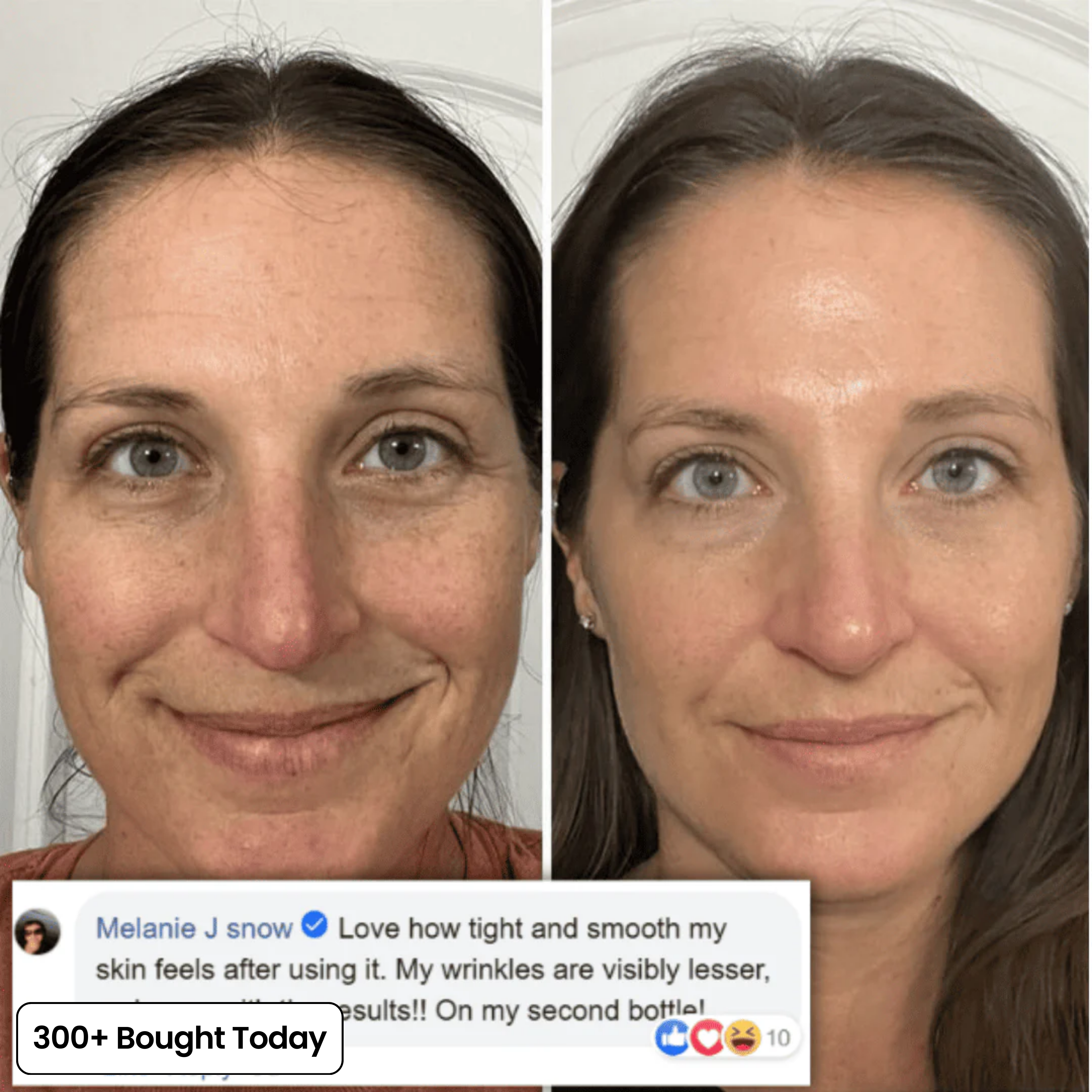PDRN Glow Balm gegen müde Augenpartie und feine Linien